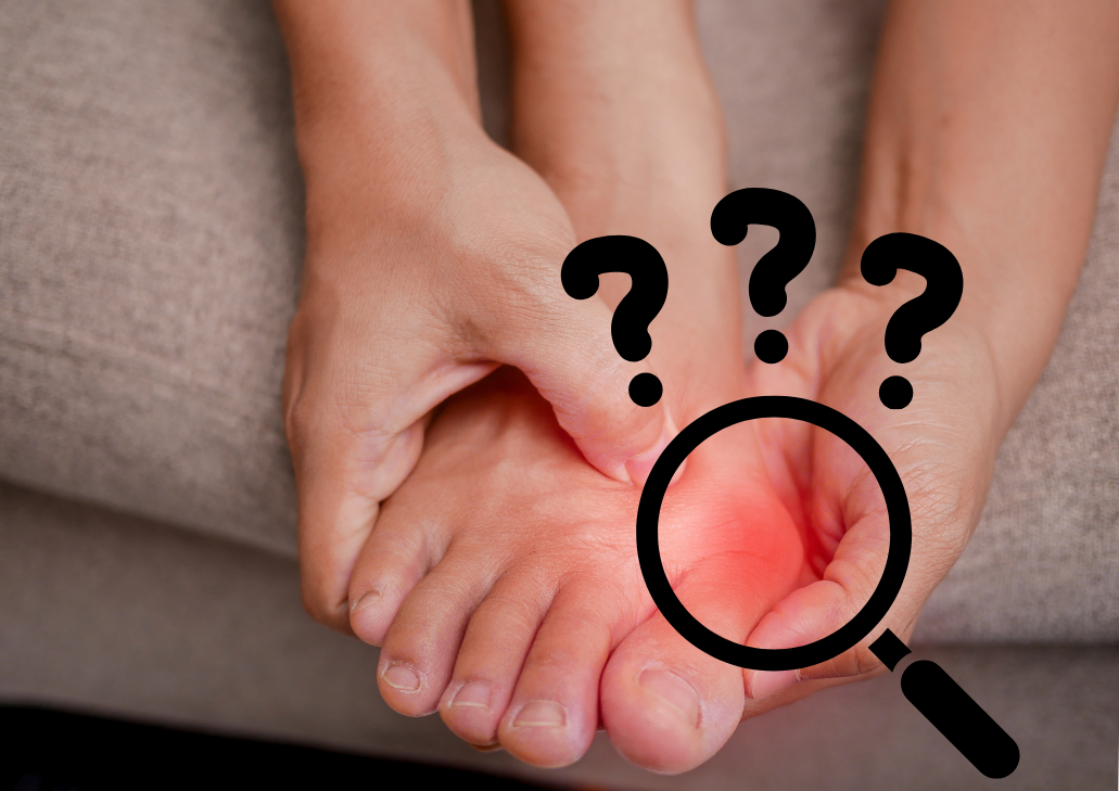 The hidden cause of bunions: what you need to know to protect your feet