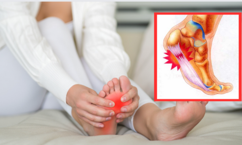 Plantar Fasciitis As A Problem? Don't Waste Your Time Stretching You Could Be Making It Worse….