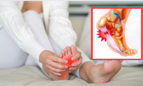 Plantar Fasciitis As A Problem? Don't Waste Your Time Stretching – You Could Be Making It Worse….