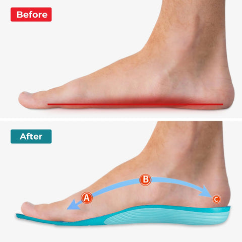 Comfysole - Walk Without Pain